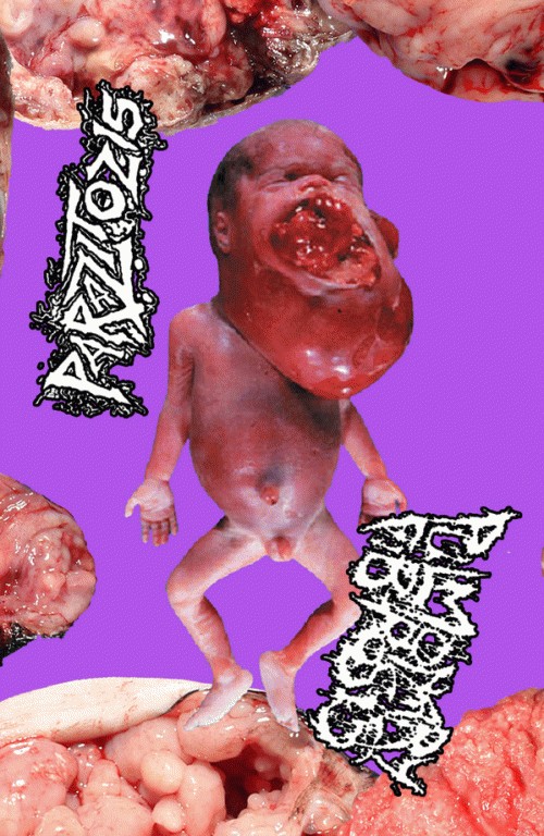 Parazitózis : Pulmonary Fibrosis - Parazitózis